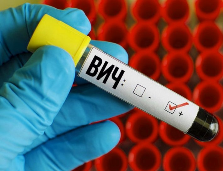 Лечение ВИЧ инфекции в Израиле